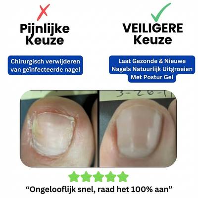 Hexro Schimmelnagel Herstelpleisters