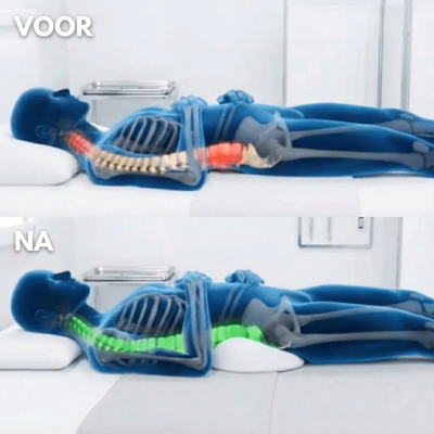 Hexro Pro™ Lumbaalkussen bij Ischias