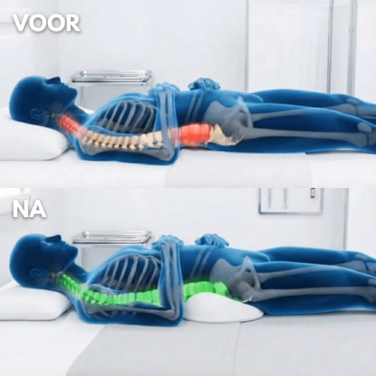Hexro Pro™ Lumbaalkussen bij Ischias