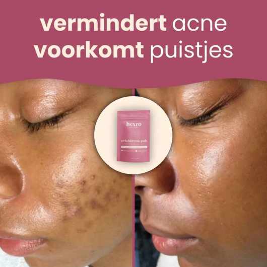 Brightening Pads met Kurkuma & Kojiczuur