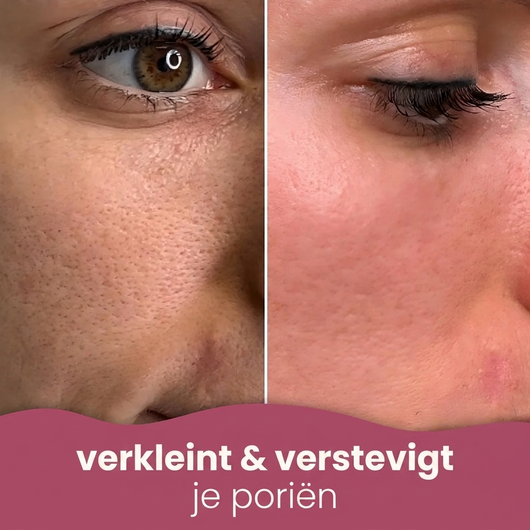 Brightening Pads met Kurkuma & Kojiczuur