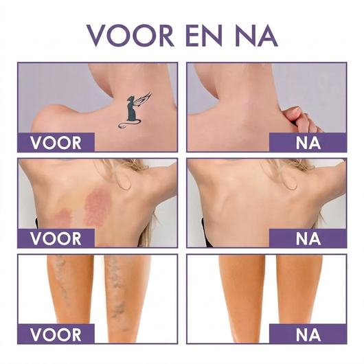 Body Perfector